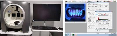 Digital imaging and qPCR analysis and comparison of short-term plaque removal effects of toothbrushing